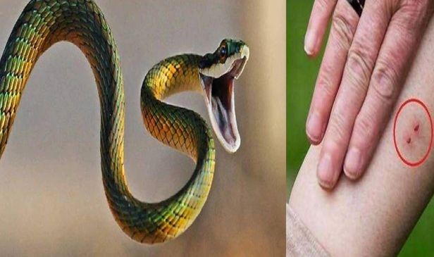 Know the symptoms and prevention of snake bite